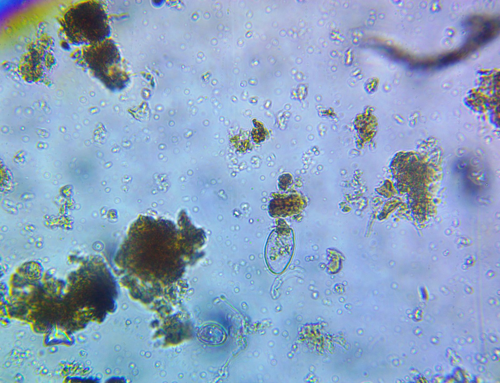 An amoeba under the microscope in a soil sample