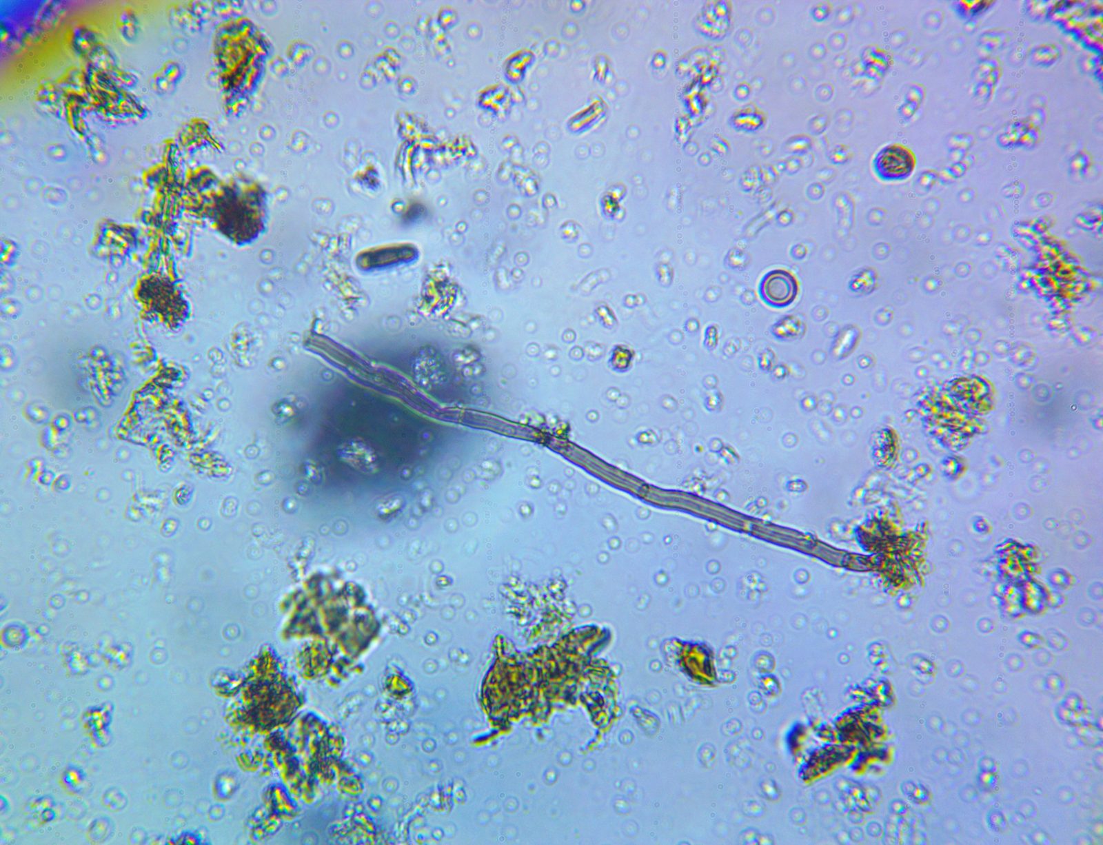 Fungal hyphae under the microscope in a soil sample