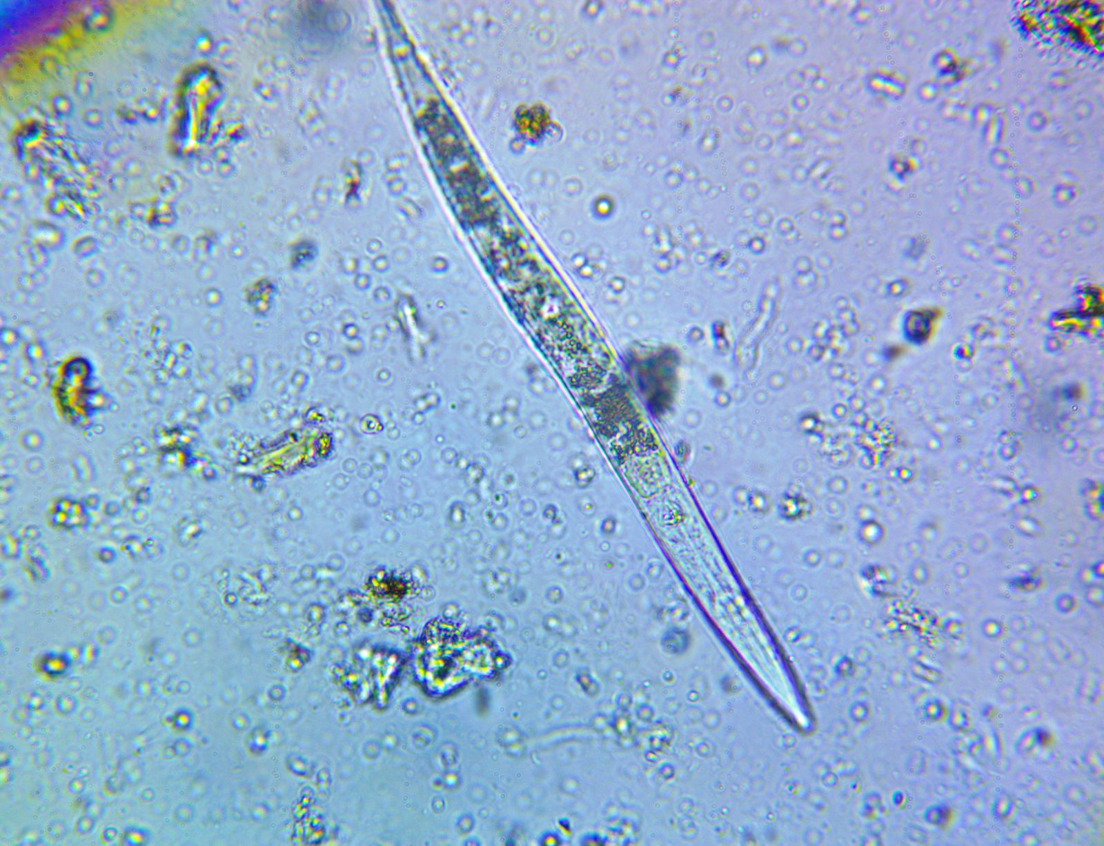 A nematode under the microscope, extracted from a soil sample