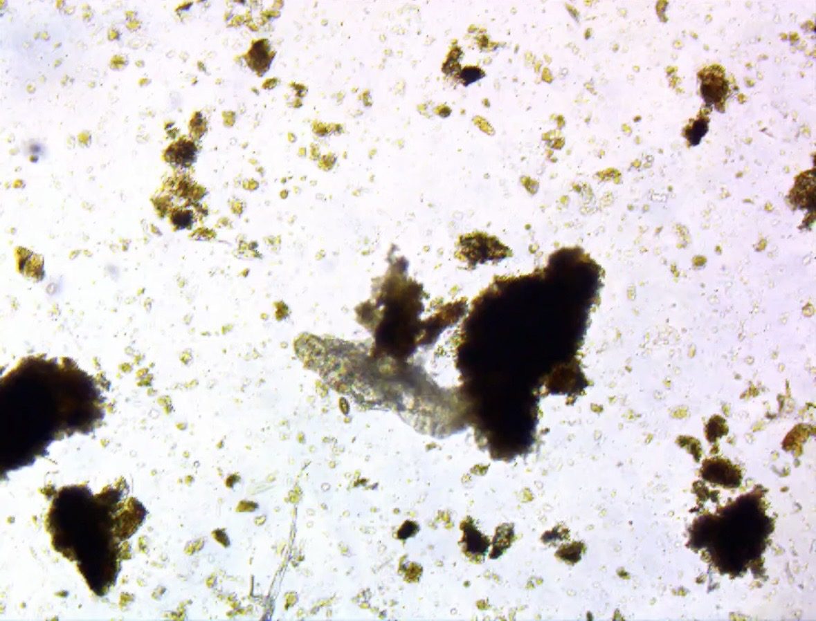 Soil fauna under the microscope in a soil sample